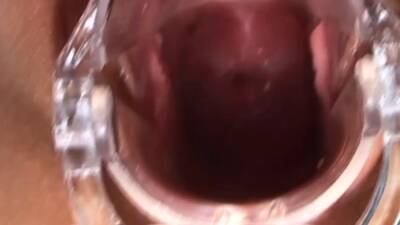 Speculum babe sucking dildo solo - drtuber.com