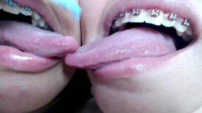 Deep tounge kissing between two brace lesbian - hclips.com