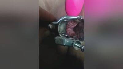 Horny Inspector: Speculum In The Pussy,is In The House! - desi-porntube.com