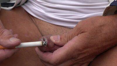 Skin - I burn my still sore piss hole with a glowing cigarette until I can peel off the burned skin. - upornia.com