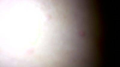 hairy feminist nightmare bitch paralytic - hclips.com