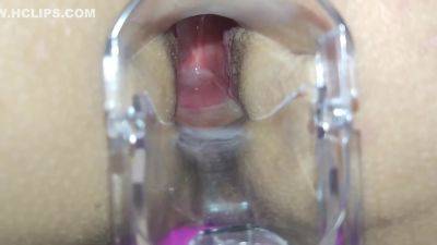 I Speculum On My Ass And Anal Orgasms In Doggy Position - hclips.com