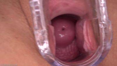 Eye Deep End On Good Cervix - InTheCrack - hotmovs.com