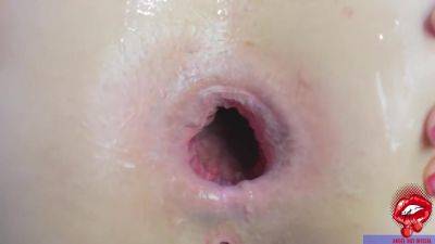 Casada Ficou Com O Cu Rasgado No Pau Do Comedor 6 Min - hclips.com