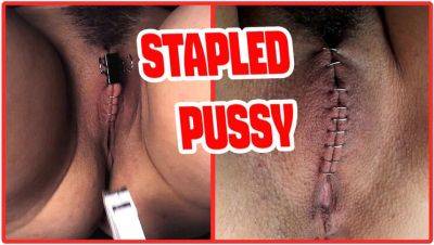 Sadistic Doctor Staples Teen Goth Girl's Hairy Pussy in Extreme BDSM Medical Punishment - veryfreeporn.com - Spain